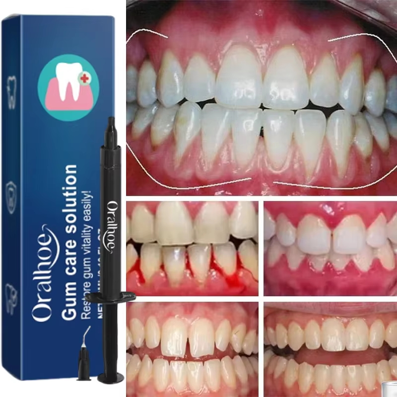 Tandenbleekgel Tandvleesrepara - Teeth Whitening Gel recensie en prijs