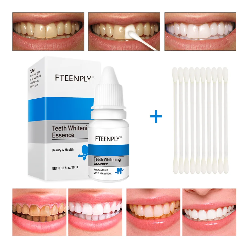 Fteenply Tanden Whitening Esse - Teeth Whitening Singapore recensie en prijs