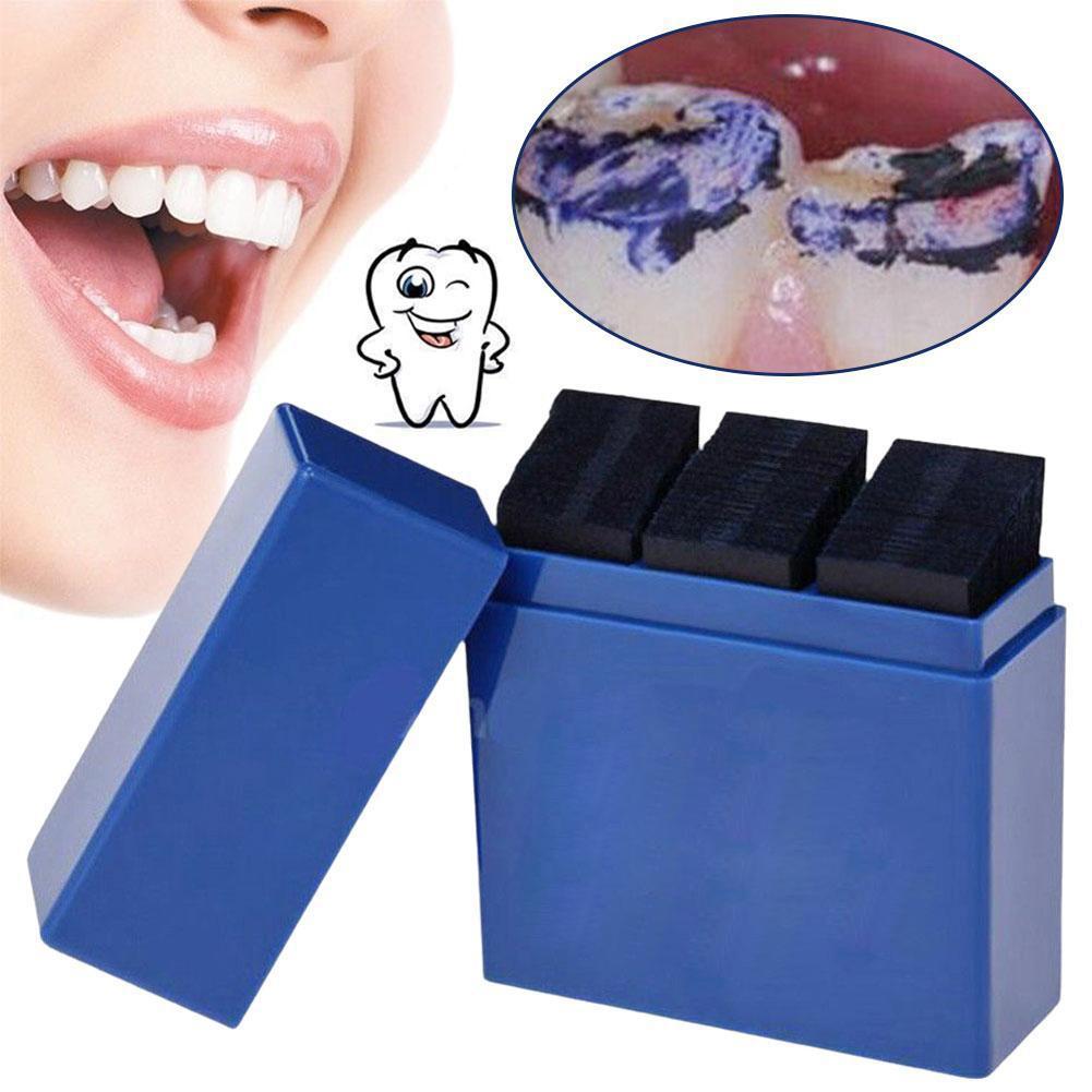 300 Vellen Tandheelkundige Art - Teeth Whitening Strips recensie en prijs