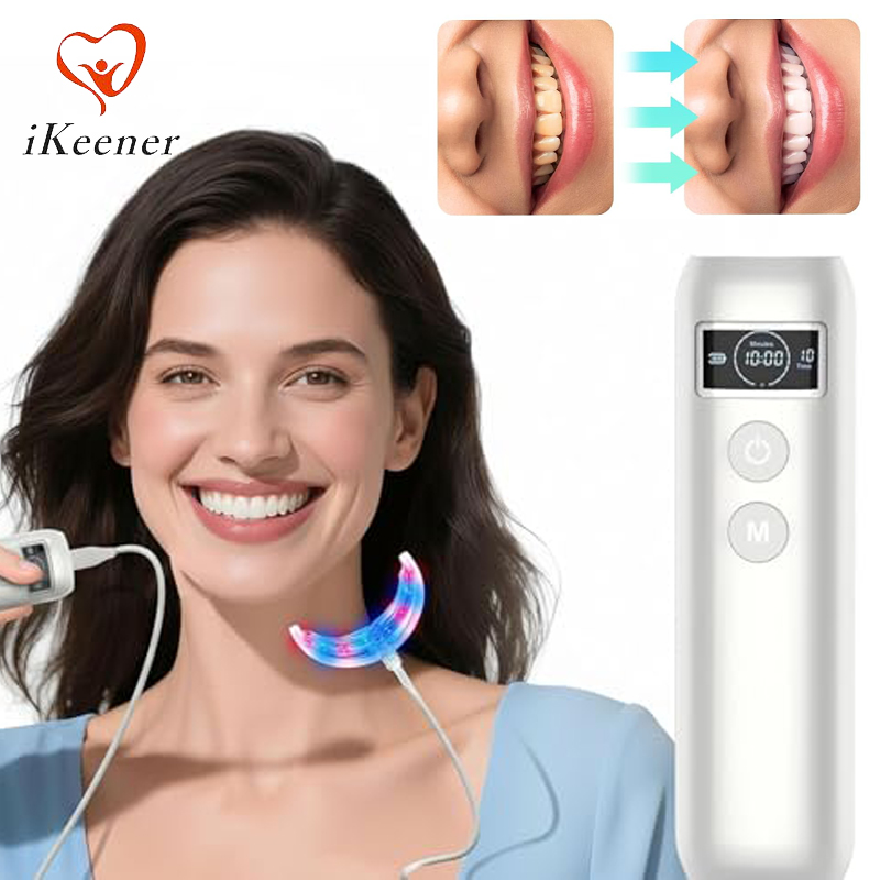 Tandenbleek-accelerator met 16 - Teeth Whitening For Trays recensie en prijs
