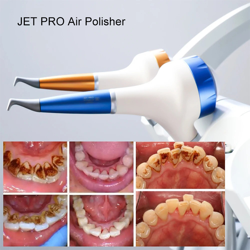 VV Dental Air Polishing Prophy - Teeth Whitening Dental recensie en prijs