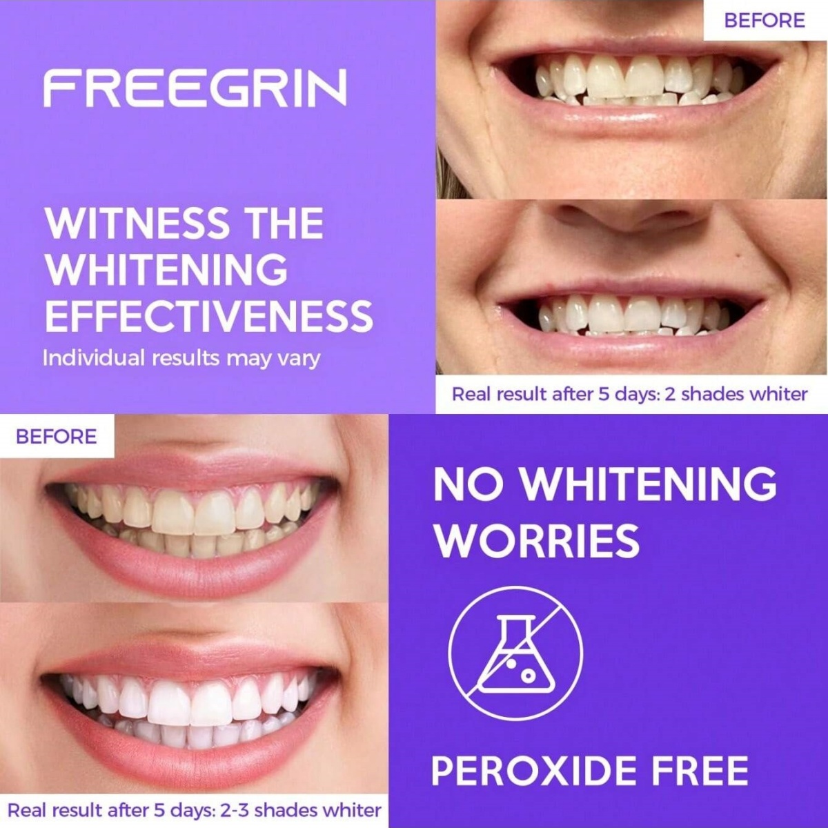 Deluxe Tanden Whitening Sticke - Teeth Whitening Singapore recensie en prijs