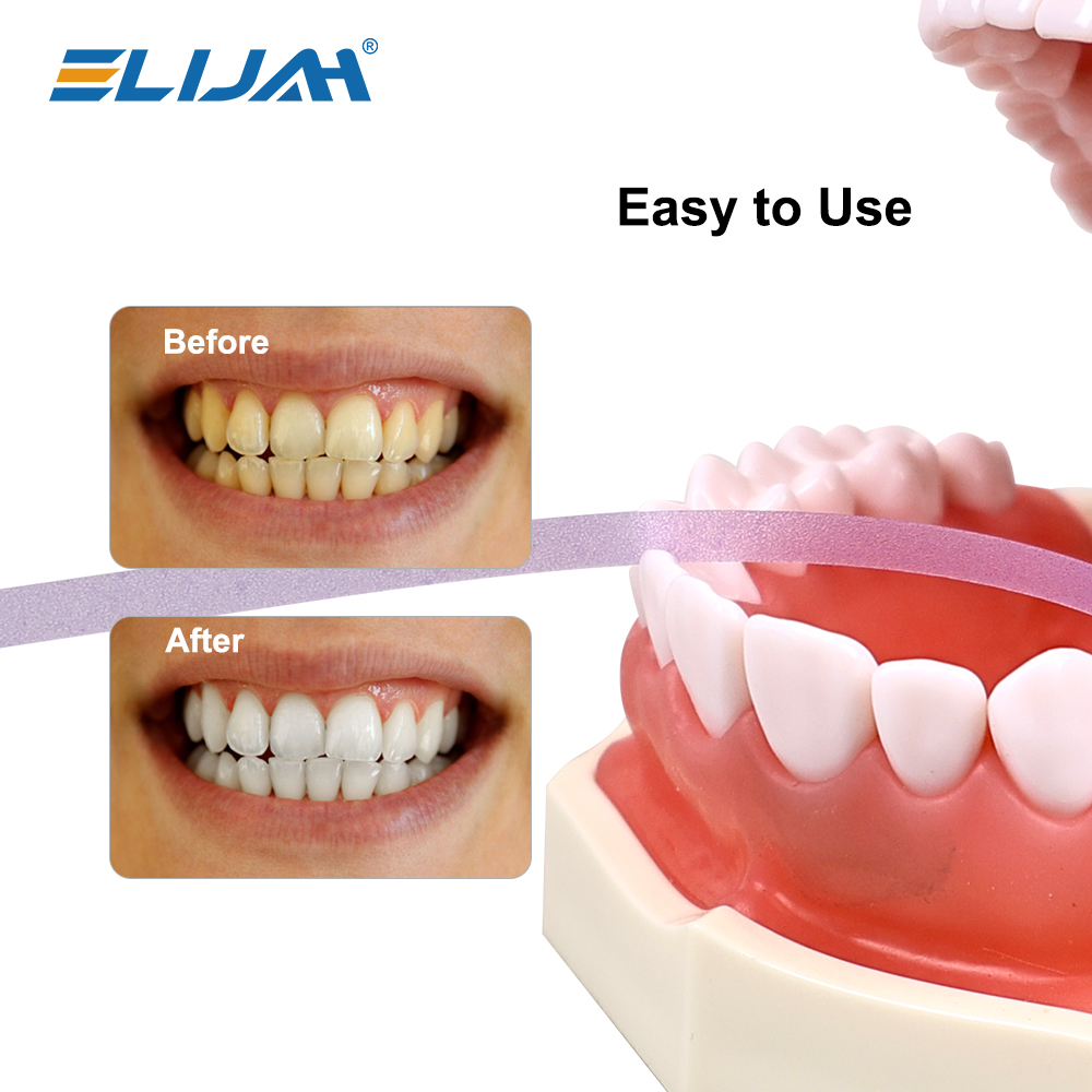 ELIJAH 1 Rol Tandheelkundige P - Teeth Whitening Strips recensie en prijs